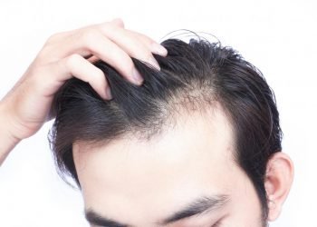 Top 5 Vitamins & Supplements for Faster Hair Growth