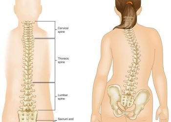 How Scoliosis is Treated