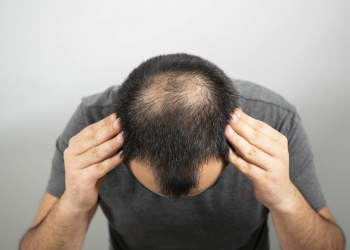 5 Hair Loss Myths You Should Never Believe – And The Truth Behind Them