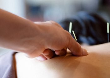 Discover How Acupuncture Can Help You Lose Weight