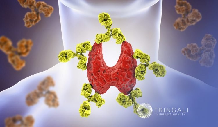 Peptide Therapy for the Treatment of Autoimmune Disease