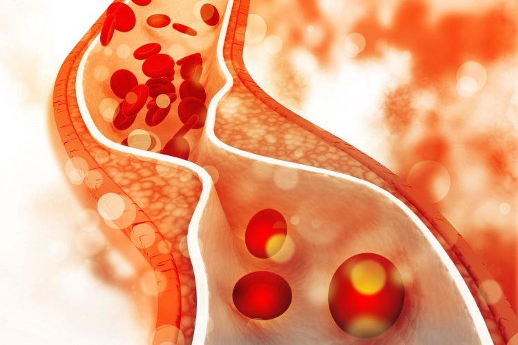 Understanding Cholesterol Markers