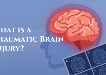 How To Handle A Traumatic Brain Injury In California