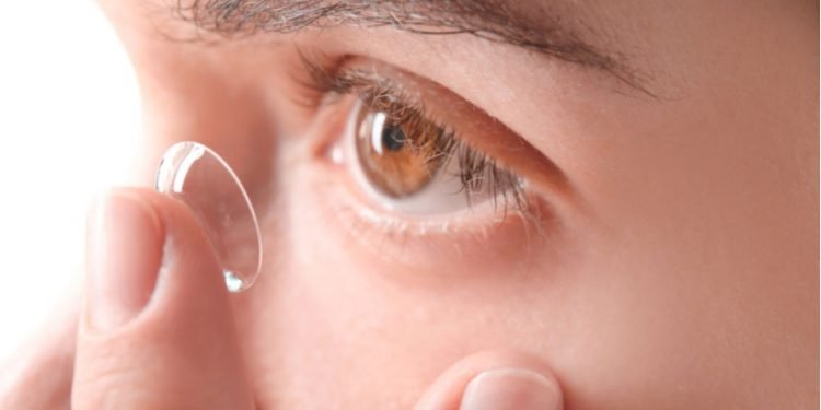 An Overview of Contact Lenses