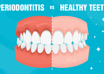 The Importance of Gum Health: Understanding and Preventing Gingivitis