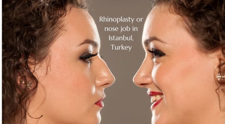 Nose Jobs Soar in Turkey: Top Destination for Rhinoplasty!