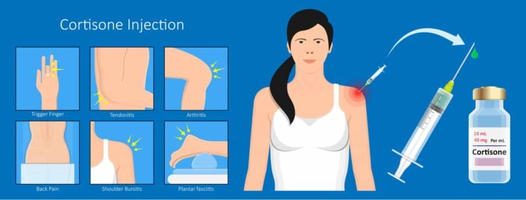 What Is Cortisone?
