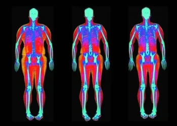 DEXA Scans And Weight Loss: A Tool For Fat Reduction