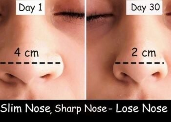 Can You Really Reduce Nose Fat? Realistic Tips and Techniques