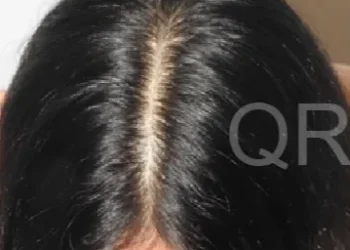Fighting Hair Fall in Ahmedabad? Here’s How QR678.com Can Help