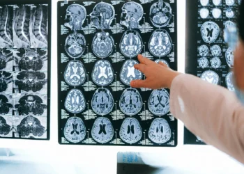 How Trauma Affects the Brain and Body